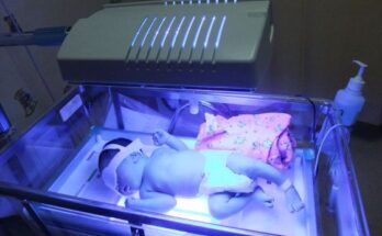 Medical Baby Phototherapy Equipment Market