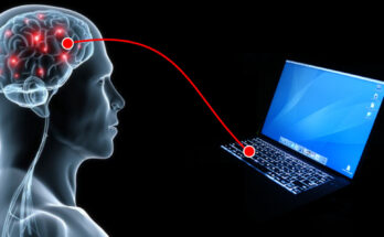 Non-invasive Brain Trauma Monitoring Devices Market
