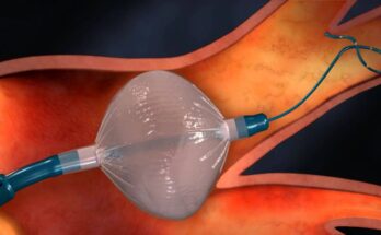 Tumor Ablation Devices Market