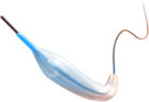 Balloon Dilatation Catheters Market