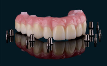 Zirconia Dental Restorations Material Market
