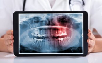 Dental X-Ray Film Digitizer Market