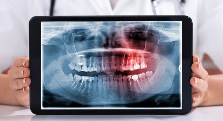Dental X-Ray Film Digitizer Market