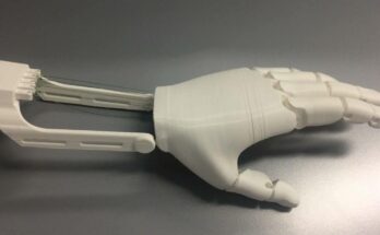 3D-Printable Prosthetics Market
