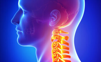 Head Pain Therapy Solutions Market
