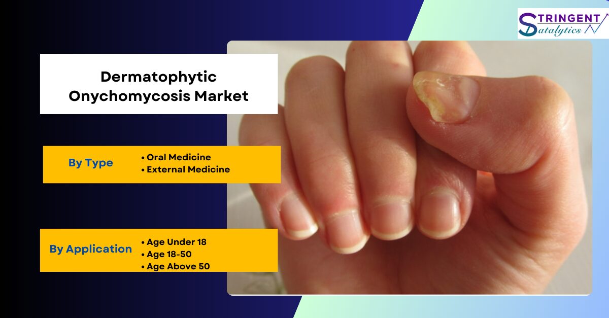 Dermatophytic Onychomycosis Market