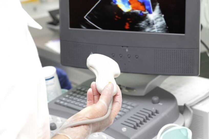 Intravascular Ultrasound (IVUS) Devices Market