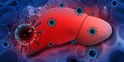 Alcoholic Hepatitis Therapeutic Market