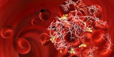 Blood Clot Preventive Drugs Market