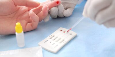 Hepatitis Diagnostics Test Market