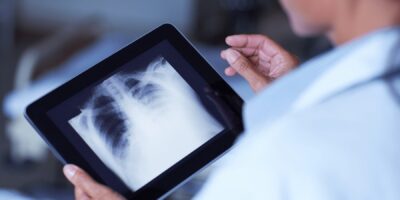 Mobile X-Ray Photography System Market