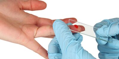 Point Of Care Diagnostics (POCD) Market