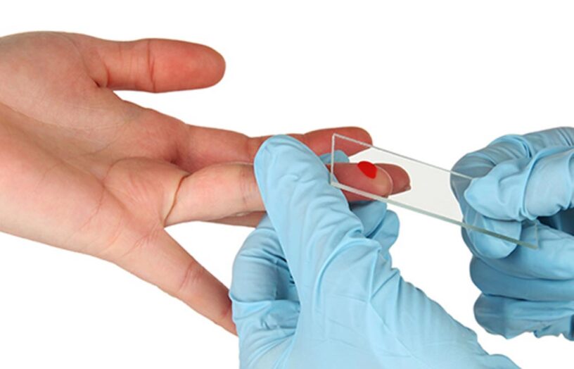 Point Of Care Diagnostics (POCD) Market