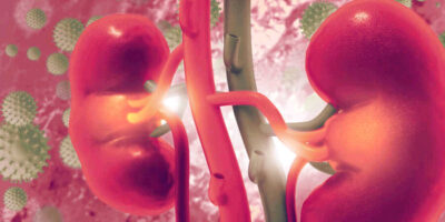 Rare Kidney Diseases Treatment Market