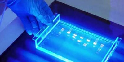 Electrophoresis Technology Market