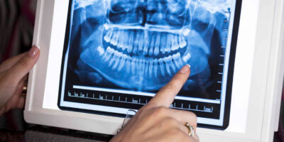 Extra Oral Dental X-Ray System Market