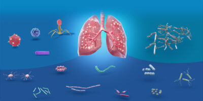 Bacterial Pneumonia Therapeutics Market