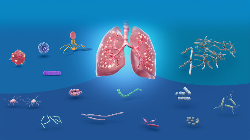 Bacterial Pneumonia Therapeutics Market