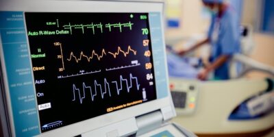 ECG Monitoring Systems Market