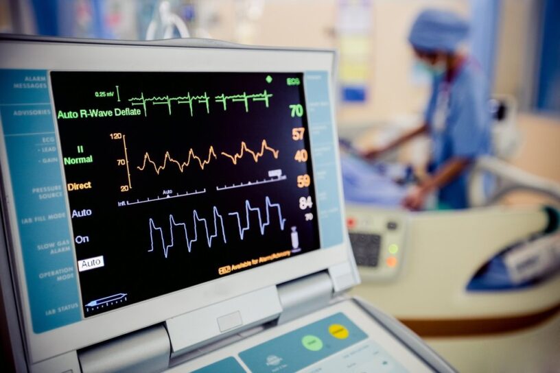 ECG Monitoring Systems Market