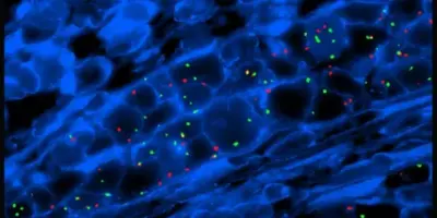 In-Situ Hybridization (ISH) Market