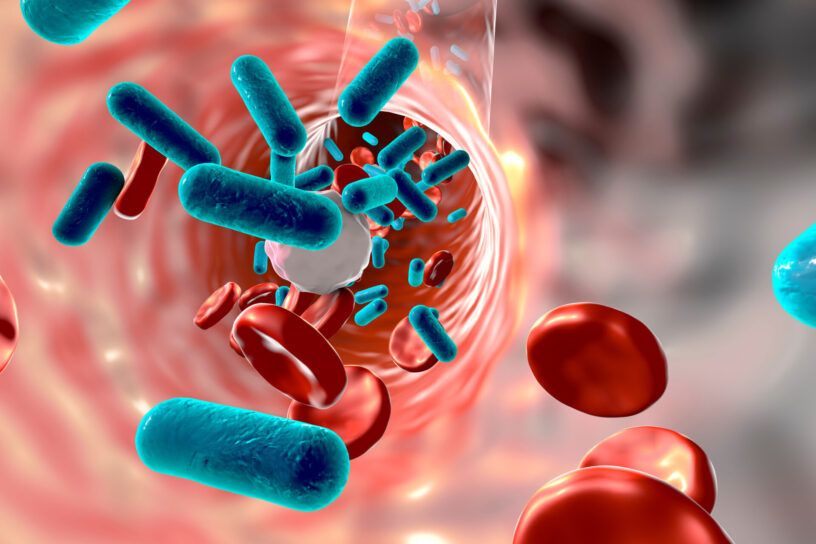 Sepsis Therapeutics Market