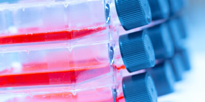 Transfection Reagents and Equipment Market