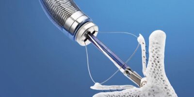 Anastomosis Assist Device Market