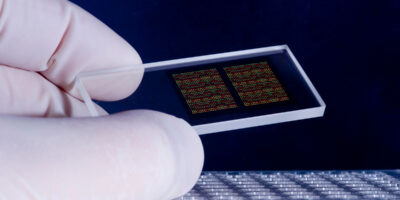 Biochip Products and Services Market