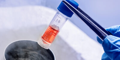 Cryopreservation Equipment in Stem Cells Market