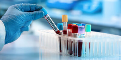 Drugs and Diagnostics for Hematological Disorders Market