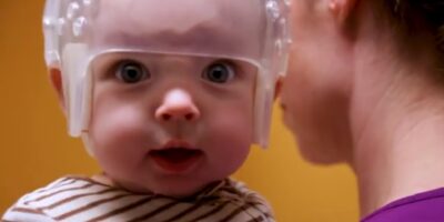 Pediatric Craniosynostosis Treatment Market