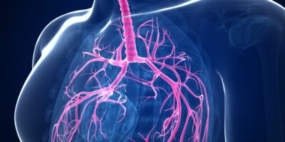 Acute Lung Injury Market