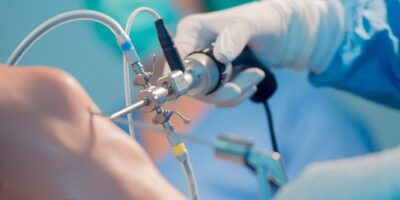 Arthroscopic Implants Market