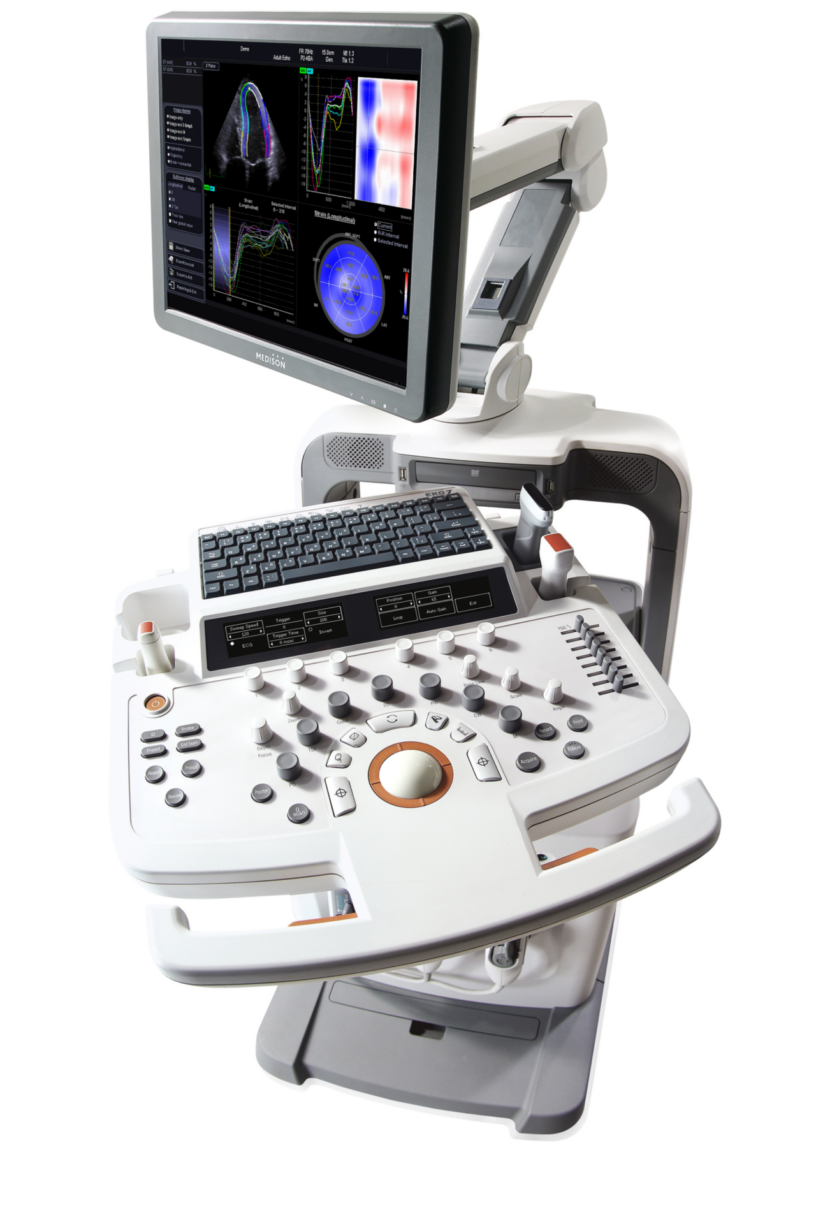 Cardiovascular Ultrasound Market