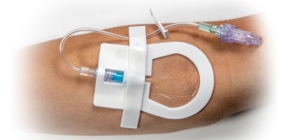 Catheter Securement Device Market