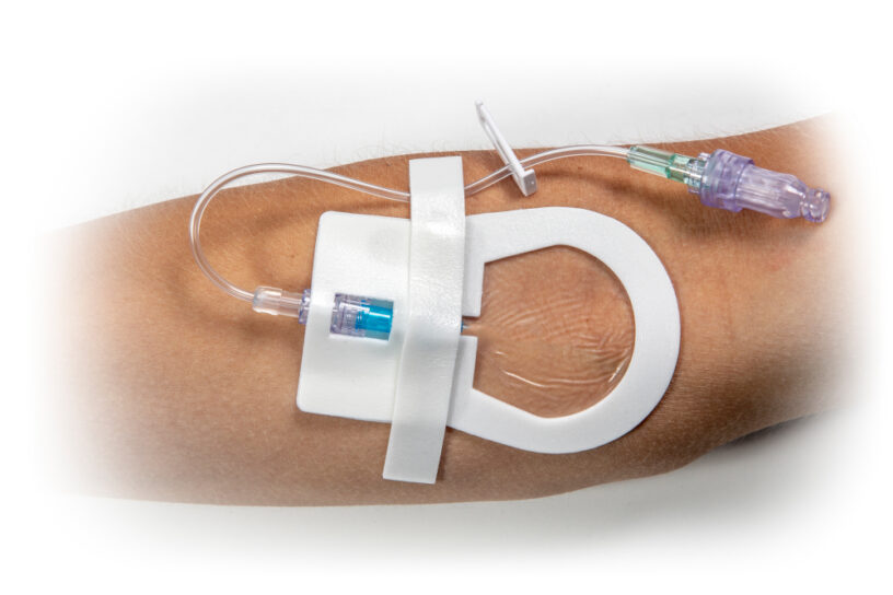 Catheter Securement Device Market