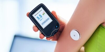 Continuous Glucose Monitoring Market