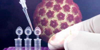 Cytology and HPV Testing Market