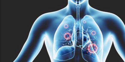 Lungs in Vitro Model Market