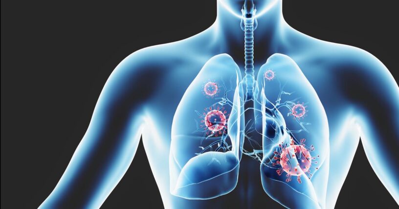 Lungs in Vitro Model Market