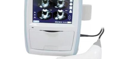 3D Ultrasound Bladder Scanners Market