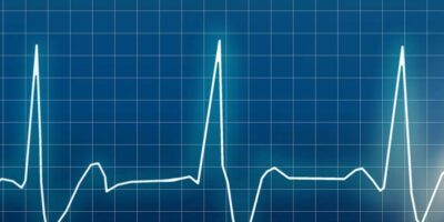 Paroxysmal Supraventricular Tachycardia Market