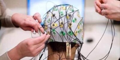 Neuro Monitoring Devices Market