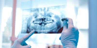 Dental Imaging Systems Market