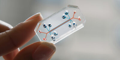 Organs-on-chips Market